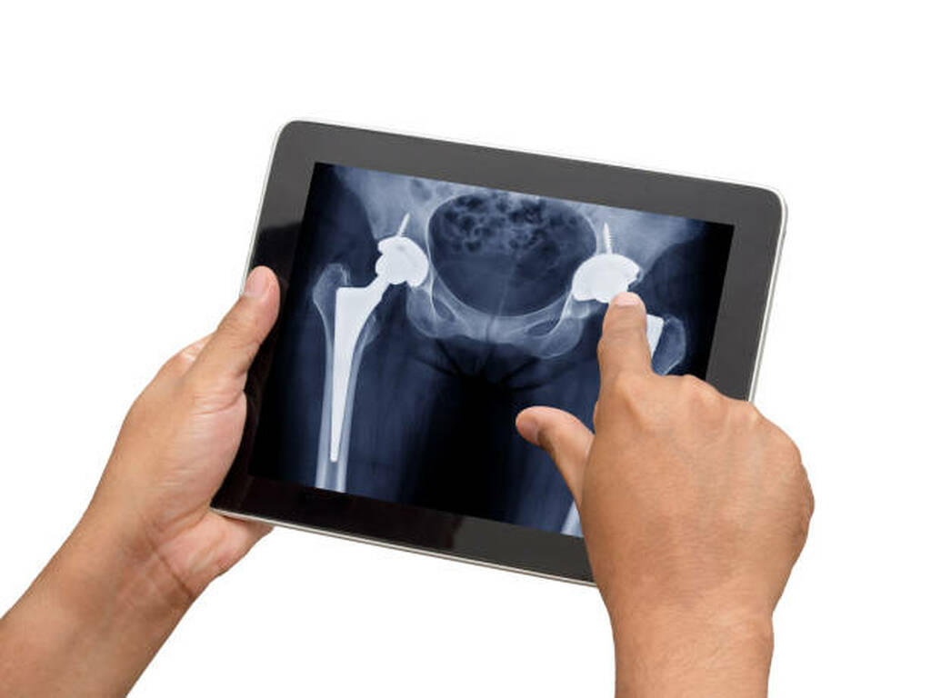 Best Hip Replacement Surgery In Panvel